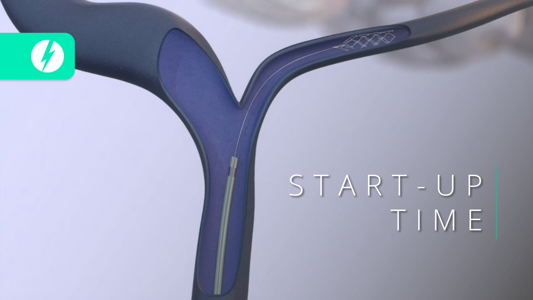 Start-up Time : CEREVASC